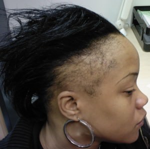 Natural Hairstyles For Thin Edges